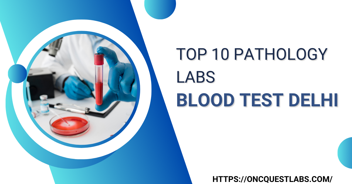 Top 10 Pathology Lab blood test Delhi